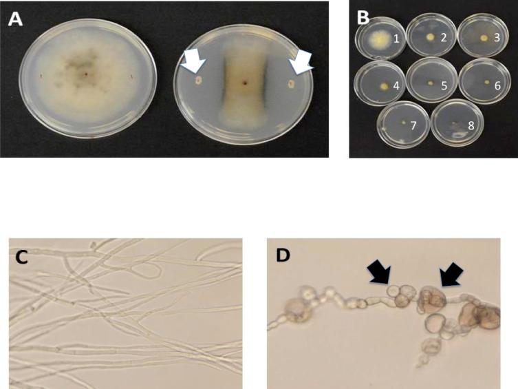 Do Symbiotic Bacteria Increase the Invasiveness of Phragmites australis?